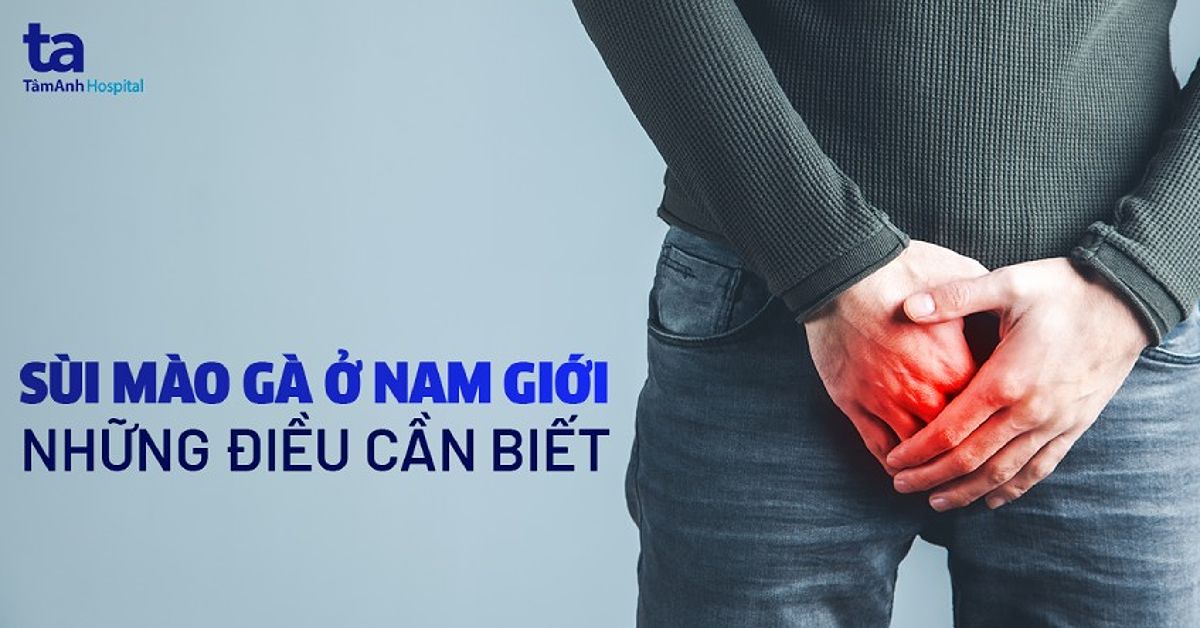 Bệnh sùi mào gà ở nam giới