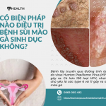 Có biện pháp nào điều trị bệnh sùi mào gà sinh dục không?